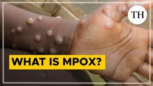 Surge Of Mpox Cases Sparks Global Health Emergency