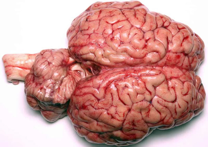 Bir beyin ikiye bölündüğünde elimizde iki tane kişi mi olur?