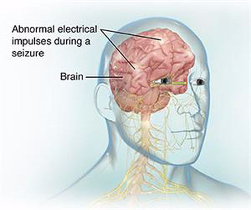 EGG ile beyinde meydana gelen anormal aktiviteler gözlemlenebilir.
