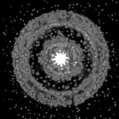  X-Ray Rings Around a Gamma Ray Burst 