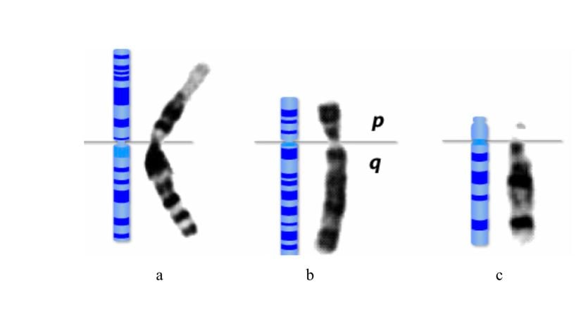 Sentromer pozisyonlarına göre kromozom tipleri