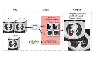 Revolutionizing Cancer Treatment Through Artificial Intelligence