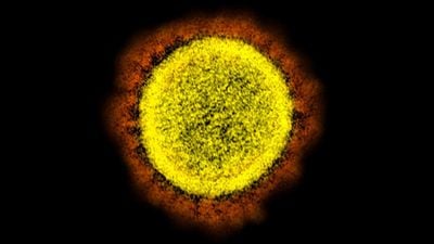 Düşmanla Burun Buruna: Mikroskop Altında Tüm Detaylarıyla SARS-CoV-2 (COVID-19 Virüsü)