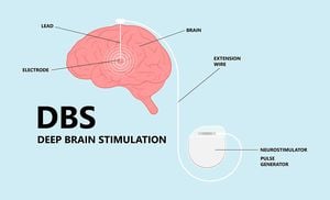 Innovative Brain Implant Promises Relief For Parkinson's Patients