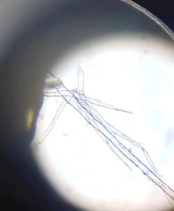 Bu bakteri hangi türe ait?