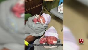 Woman Defies Odds With Rare Twin Birth