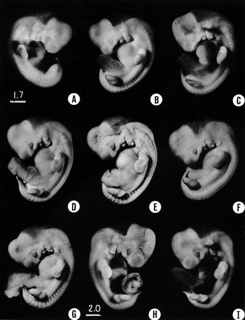 16. evrede bulunan (37 günlük) üç ayrı insan embriyosu.