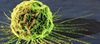 Nanoparçacıklar Kanser Hücrelerini Öldürebilir ve Yayılımını Durdurabilir!