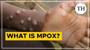 New Deadly Mpox Variant Triggers Alert Across Asia