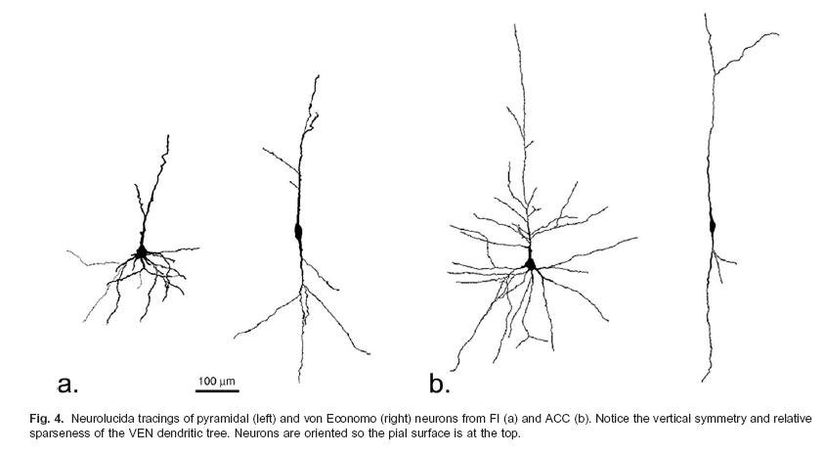 Normal piramidal nöron (a) ve von Economo nöron tipinin (b) morfolojileri
