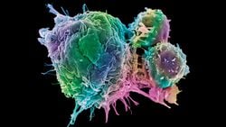 Kanımızdaki "Seri Katiller": T Hücreleri ve Yaptıkları "Katliamın" Anlık Görüntüleri!