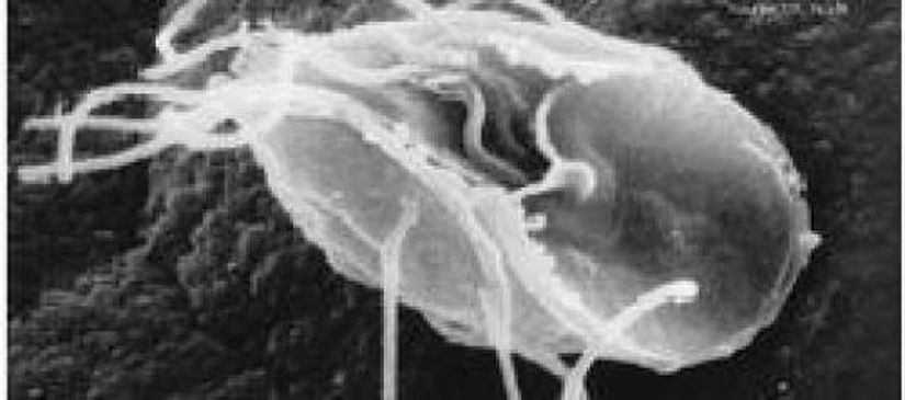 Giardia intestinalis (Metamondia)
