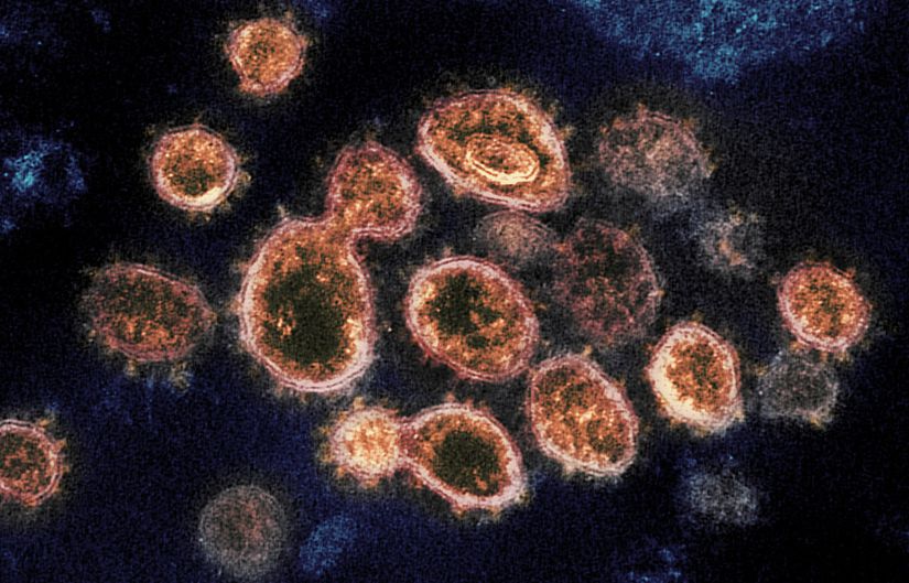 İşaretlenmiş SARS-CoV-2 virüsü