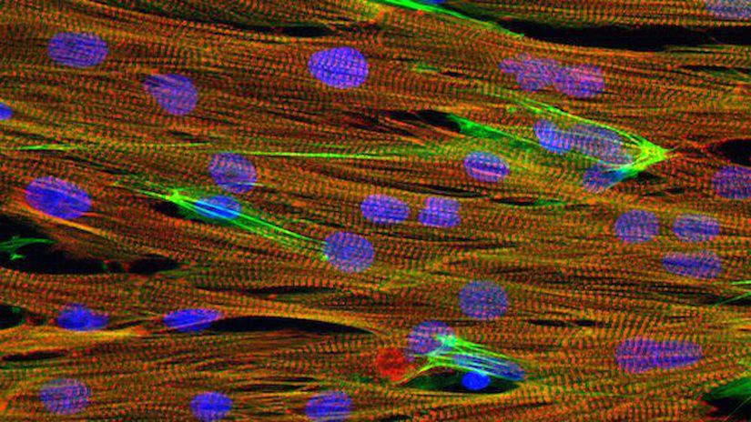 Aktin (yeşil), çekirdekler (mavi) ve kalp miyositleri (kırmızı) olan çip fare kalbi dokusunun mikroskobik görüntüsü. – Megan MccCain Vve Nethika Ariyasinghe, Southern California Üniversitesi