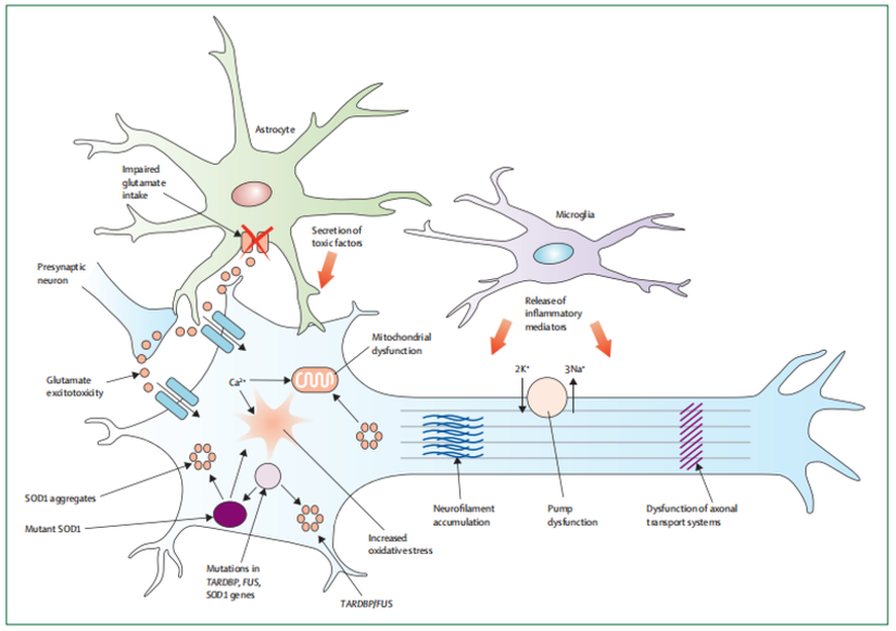 ALS'deki nörodejenerasyonun altında yatan mekanizmalar çok faktörlüdür ve birbiriyle ilişkili moleküler ve genetik yollarla çalışır. Spesifik olarak, ALS'deki nörodejenerasyon, glutamat eksitotoksisitesinin, serbest radikallerin, sitoplazmik protein agregalarının, SOD1 enzimlerinin, mitokondriyal disfonksiyon ile birlikte ve nörofilament hücre içi agregatların birikimi yoluyla aksonal taşıma süreçlerinin bozulmasının karmaşık bir etkileşiminden kaynaklanabilir. TARDBP ve FUS'taki mutasyonlar, nöronlara zararlı olan hücre içi agregatların oluşumuna neden olur. Mikroglianın aktivasyonu, proinflamatuar sitokinlerin salgılanmasına ve daha fazla toksisiteye neden olur. Sonuçta, motor nöron dejenerasyonu, kalsiyuma bağlı enzimatik yolların aktivasyonu yoluyla gerçekleşir.