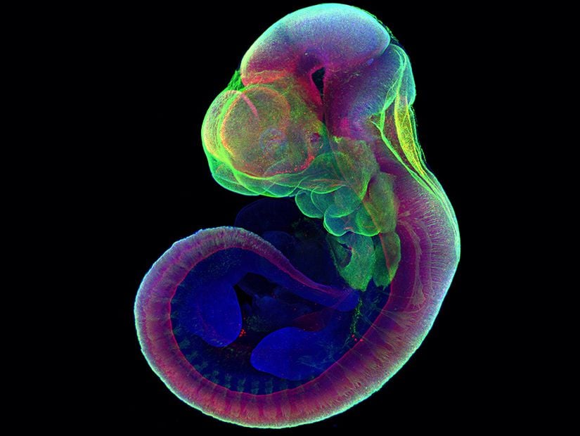 Rahmin dışında büyütülmüş sentetik fare embriyosunun mikroskop altındaki görüntüsü. Kalp ve beyin oluşumunun karşılaştırılabilmesi için renklendirilmiştir.