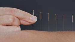 Akupunktur: İşlevsel Gibi Gözüken İşlevsiz Bir Sahtebilim Dalının Bilimsel Değerlendirmesi