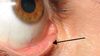 Lacrimal Punctum: Göz Kapaklarınızda Bulunan Ufak Delik Ne İşe Yarar? Ağladığımızda Neden Burnumuz Akar?