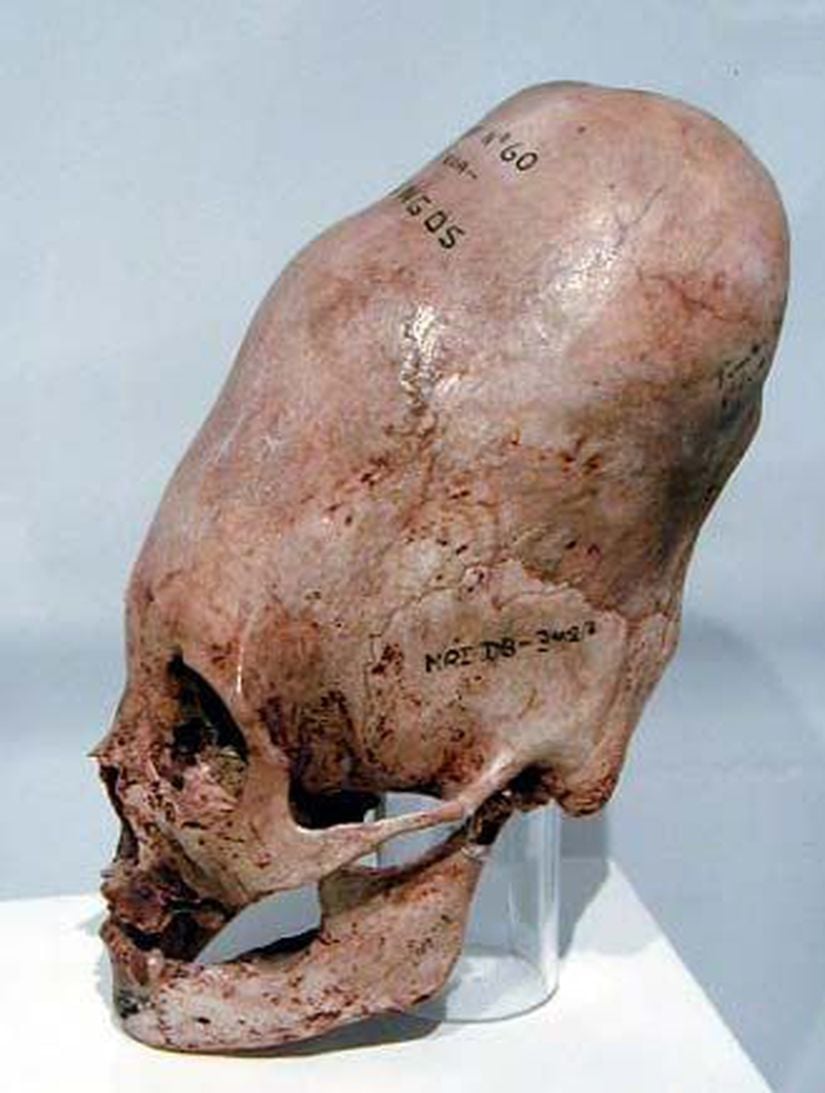 Mayalılar'a ait olan ama hatalı bir şekilde uzaylılarla ilişkilendirilen bir kafatası