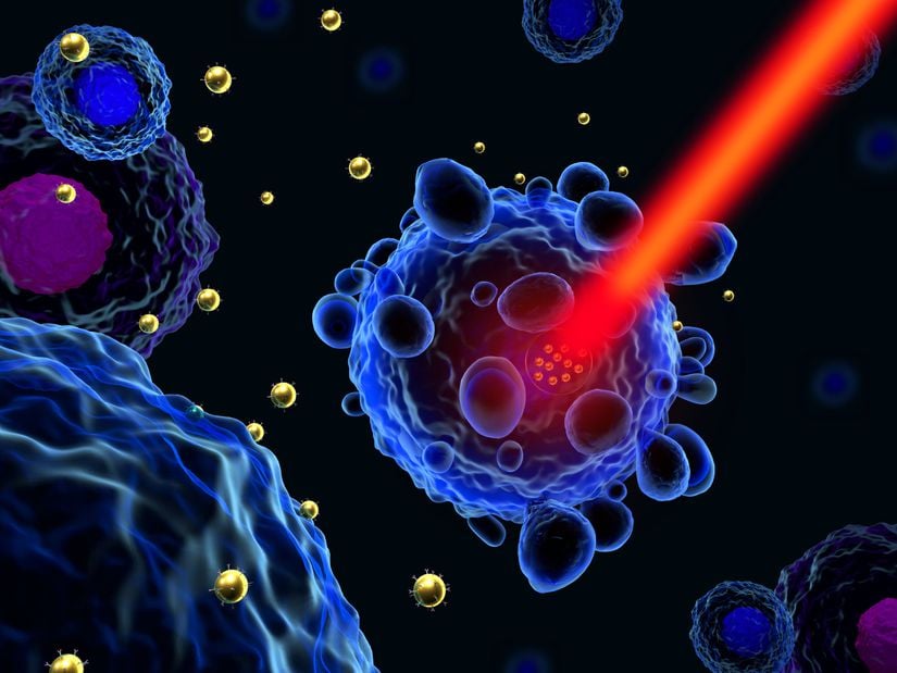 Kanser tedavisinde altın nano parçacıklar