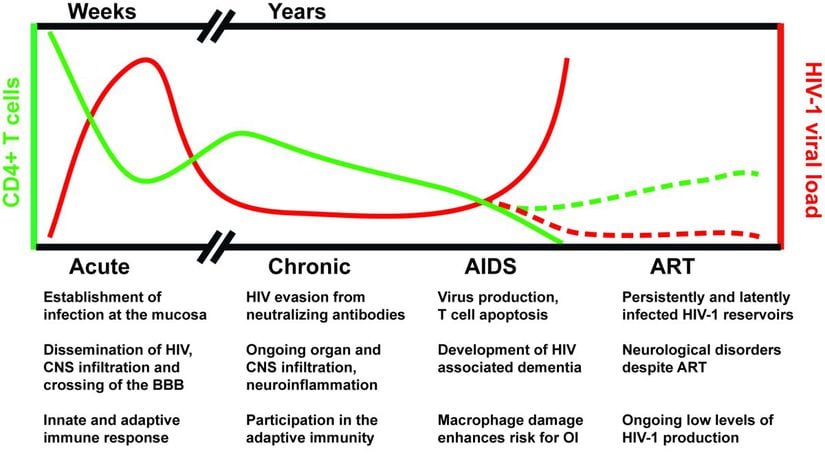 AIDS hastalığının gelişimi sırasında, HIV'in ilk bulaşmasından sonraki 4 temel hastalık fazında meydana gelen değişimleri gösteren bir grafik. İlk evrede HIV vücuda giriyor ve vücut-beyin bariyerini aşıyor. Hemen savunma sistemi devreye giriyor. Ancak yeterince güçlü olamadığı için HIV hızla yayılmayı sürdürür. Sonrasında geçici olarak bağışıklık sistemi üstün gelir ve HIV kronik faza girerek sabit bir seyirde devam eder. Bu sırada çeşitli organlara bulaşmayı sürdürür. AIDS'in semptomları belirmeye başlar. Birey enerjisini yitirmeye başlar, kilo kaybı olur, sık sık ateş ve terleme görülür, mantar enfeksiyonları başlar, deri sıklıkla kızarır, kısa dönem hafıza kayıpları başlar, ağızda, cinsel organlarda ve anüste sivilceler oluşmaya başlar. Nihayetinde seri virüs üretimi başlar ve savunma hücrelerimiz ölmeye başlar. Hastalığın seyri ilerledikçe daha ağır semptomlar oluşur: öksürük ve nefes darlığı, nöbetler, koordinasyon bozukluğu, yutkunma güçlüğü, kafa karışıklığı, sürekli ishal hali, ateş, görüş kaybı, mide bulantısı ve mide krampları, aşırı bitkinlik, aşırı baş ağrısı, koma, vb.