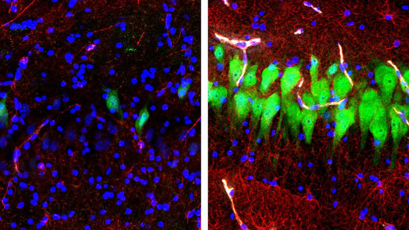 Sol tarafta, 10 saattir ölü bir beyindeki nöron (yeşil), astrosit (kırmızı) ve hücre çekirdekleri (mavi) gözüküyor. Sağ tarafta ise Yale Üniversitesi ekibi tarafından geliştirilen BrainEx'e bağlanan domuz beyinlerinin ölümden 4 saat sonraki durumu gösteriliyor.