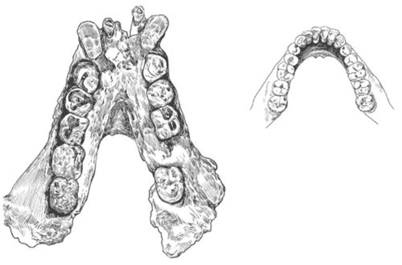 Gigantopithecus (Fosil Çizim)