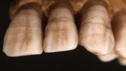 Tarihöncesi İnsan Dişleri, Gerçek "Paleo Diyeti"nde Tahıl Ürünleri Olduğunu da Gösteriyor!