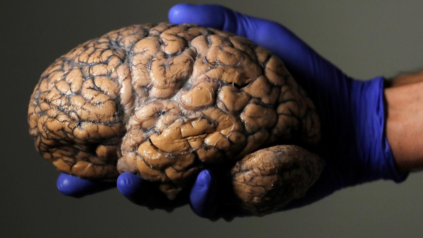 Beyinle Ilgili 10 Yanlis Bilgi Ve Bunlarin Gercekleri Evrim Agaci
