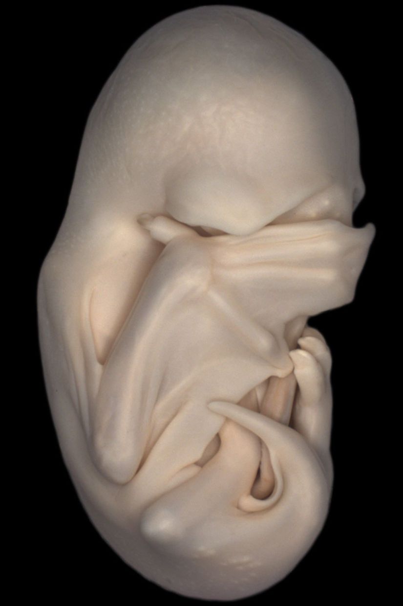 Molossus rufus olarak bilinen siyak mastif yarasası embriyosu