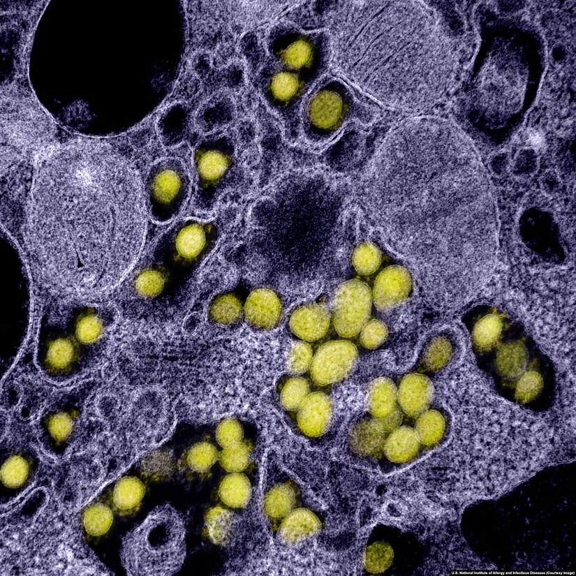 İnsan hücreleri içindeki SARS-CoV-2 koronavirüsleri