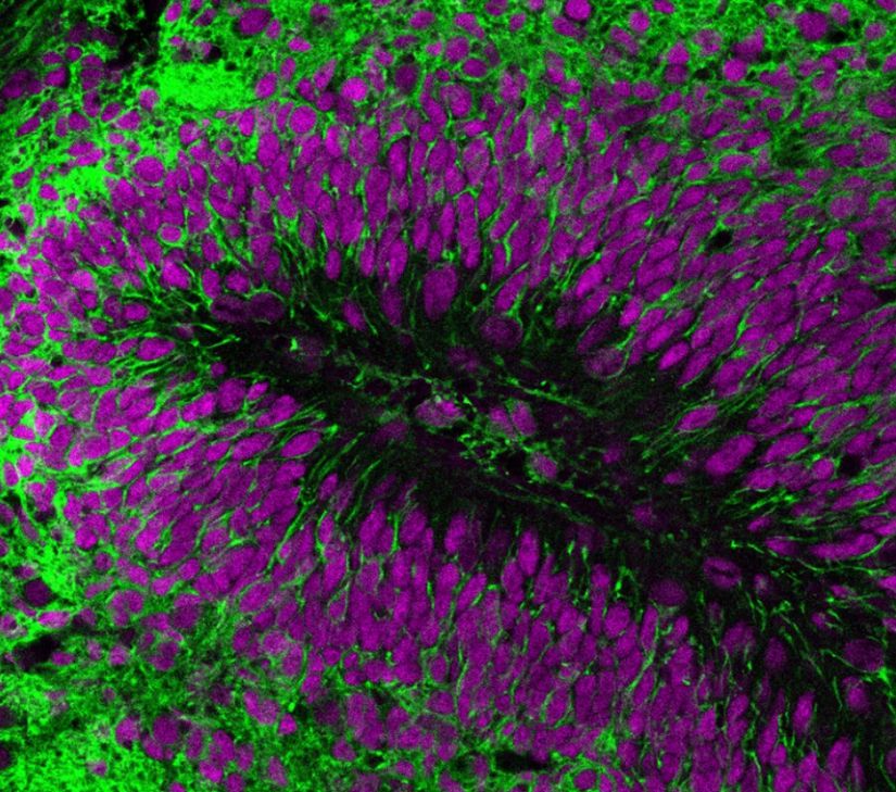 İnsan sinir hücreleri ve çekirdeklerinin fare beynine nakledildikten 2 ay sonraki görüntüsü