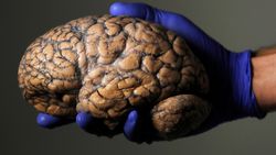Beyinle İlgili 10 Yanlış Bilgi ve Bunların Gerçekleri