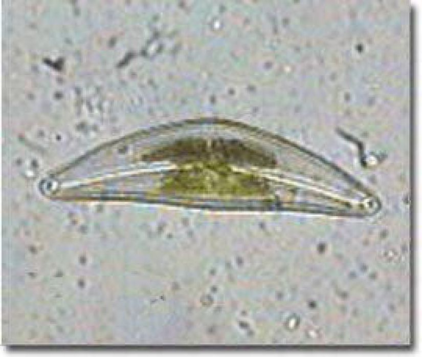 Cymbella (Heterokontophyta)