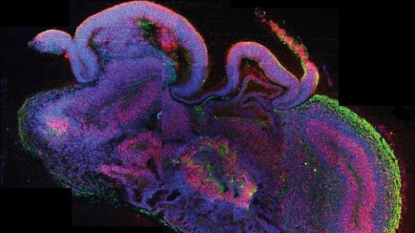 Tam bir organoidin enine kesiti; nöral kök hücreler kırmızı ile, nöronlar yeşil ile renklendirilmiş.