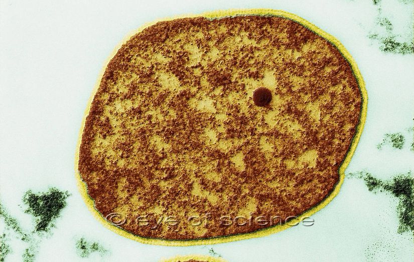 Sulfolobus acidocaldarius (ortadaki sarı) türü arke ve etrafını saran mantarların (yeşil) 130.000 kat büyütülmüş mikroskop görüntüsü. Bu arkeler 70-75 santigrat derecede en uygun şekilde çalışabilirler (kıyaslama açısından, vücudumuzdaki hücreler 37 derecede en uygun şekilde çalışabilirler). En sevdiği pH aralığı ise 2-3'tür, yani asit sevicidir (kıyas bakımından vücudumuzdaki birçok hücre 7.2-7.4 civarında pH değerinde çalışabilir).