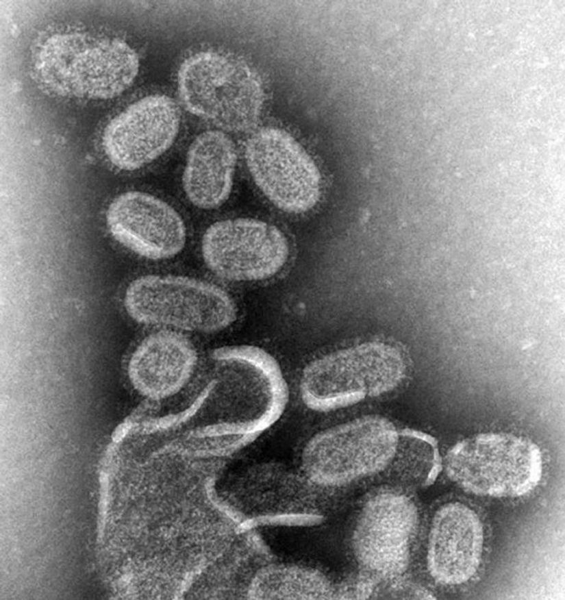 Grip (influenza) virüsünün 100.000 kez büyütülmüş hali.