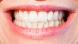 Dişlerimizde Evrimin İzleri: Diş Minesi ve ENAM Genlerinin Evrimi
