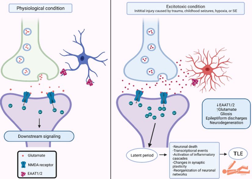 Epilepsi gelişimine yol açan fizyolojik ve eksitotoksisite koşulları altında üç parçalı glutamaterjik sinapsların temsili.