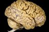 Sinirbilim ve Beyin - 5: Beyin İle İlgili Temel Terimler, Tanımlar ve Açıklamalar