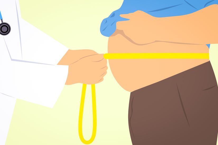 Obezite, vücutta yağ birikiminin veya yağ dokusunun aşırı biçimde artmasına bağlı kronik bir hastalıktır.
