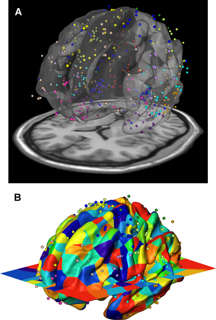 Allen Beyin Atlasına göre gen ifadesi gerçekleşen beyin bölgeleri. A bölümünde beynin hacimsel kayıtları incelenirken, B bölümünde gen ifadesi verileri haritalanmıştır.