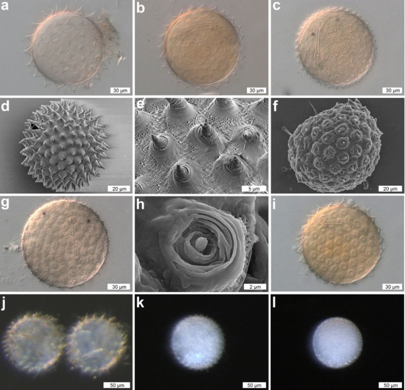 Dactylobiotus ovimutans’ın şaşırtıcı yumurta morfolojisi, A) Diferansiyel mikroskobu altında yumurtanın çemberine dizilmiş 20 piramit yapısı, B) Diferansiyel mikroskobu altında yumurtanın çemberine dizilmiş 25 piramit yapısı, C) Diferansiyel mikroskobu altında yumurtanın çemberine dizilmiş 37 piramit yapısı D) SEM’de piramitleri dışa doğru uzatılmış halde bulunan dış yumurta katmanı E) SEM’de piramitlere yakından bakış, F) SEM’de piramitleri içeri çekik olan dış yumurta katmanı G) Diferansiyel mikroskobunda piramitleri içe çekik olan dış yumurta katmanı H) SEM’de pramitleri içe çekik olan dış yumurta katmanının yakınlaştırılmış hali I) Diferansiyel mikroskobunda düzensiz açılım gösteren piramitler, J-K-L) Stereo mikroskobunda yumurtanın farklı halleri.