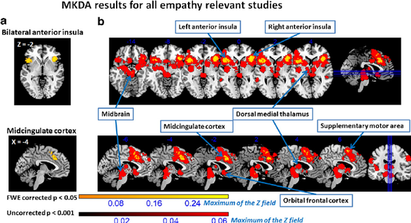Tüm empati çalışmalarında tutarlı aktivasyon gösteren beyin bölgeleri
