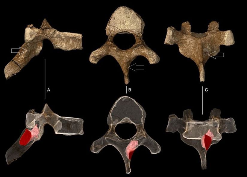 Australopithecus sediba vertebra ve lezyonu. Paul Tafforeau (ESRF)