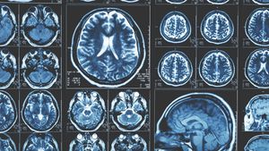 How Causal Reasoning Could Revolutionize Medical Imaging