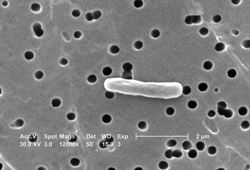 Elektron mikroskobu altında bir Escherichia coli bakterisi.
