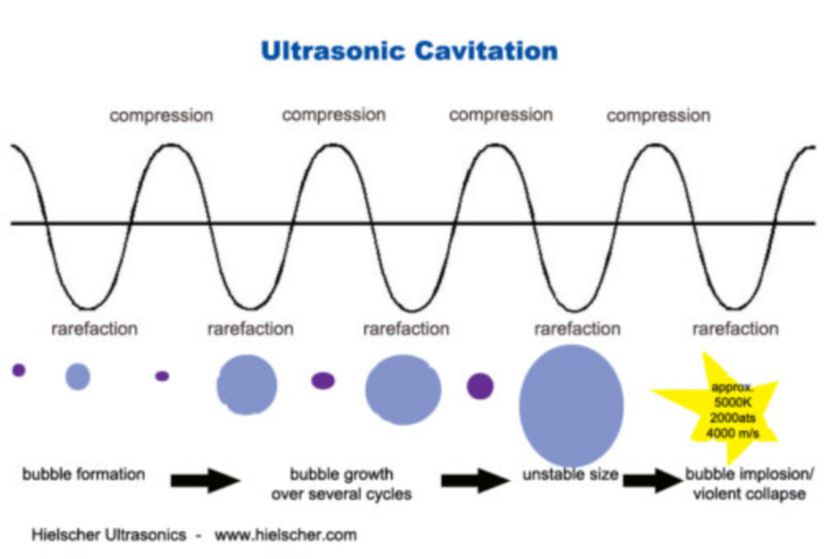 Ultrasonik Kavitasyon