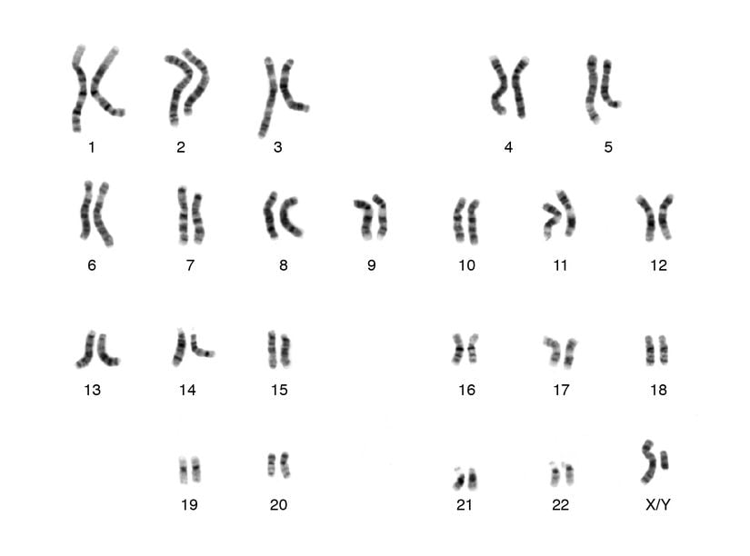 Sağlıklı insanın kromozom karyotipi. Karyotip, kromozomların anormal sayılarını veya yapılarını aramak için kullanılır.