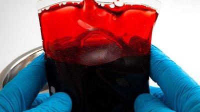 Bombay Kan Grubu (hh Kan Grubu) Nedir? Bu Nadir Kan Grubunu Bilmek Neden Önemlidir?
